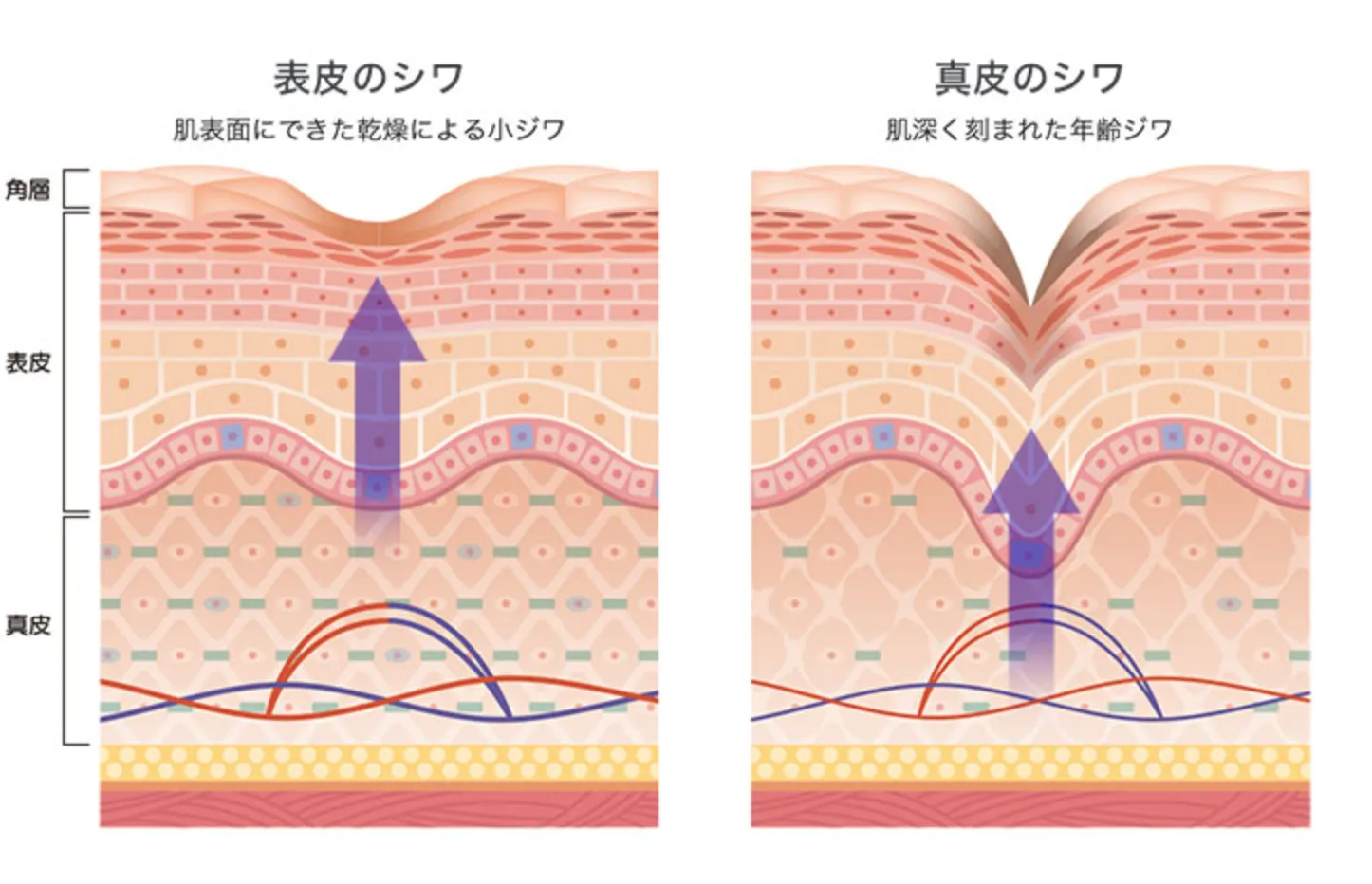 ナイアシンアミドの作用